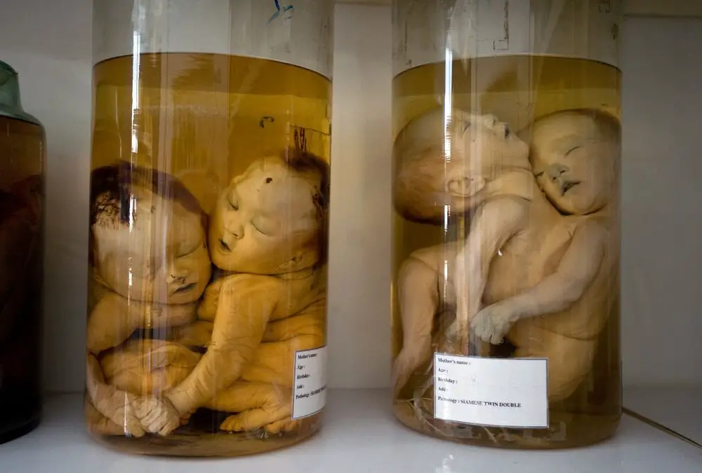 Preserved babies affected by Agent Orange
